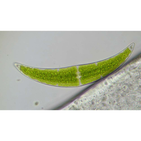 bresser-researcher-trino-40-1000x-professional-microscope_3